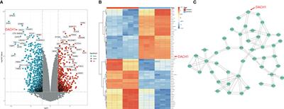 Identification and verification of the temozolomide resistance feature gene DACH1 in gliomas